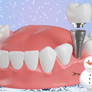Winter’s Chill and Dental Implants: A Perfect Match?