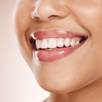Top Cosmetic Dental Treatments to Get Before Christmas