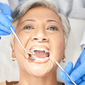 The Importance of Dental Checkups Even Without Discomfort
