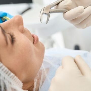 The Risks of Delaying a Necessary Tooth Extraction