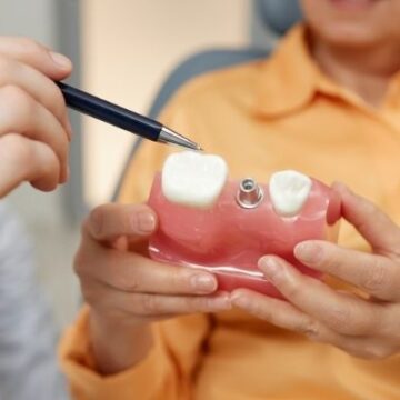 Tips for a Quick Dental Implant Recovery