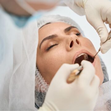 Importance of Plaque Control Before It Becomes Tartar