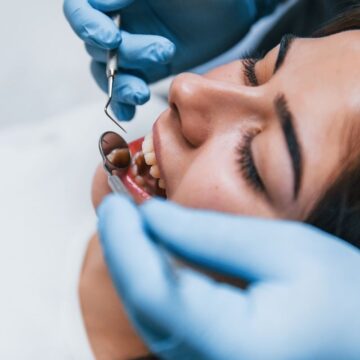 White Patch in Your Mouth: What Could It Mean?